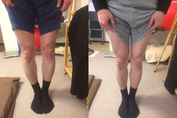 やまのて整体O脚矯正説明(写真)